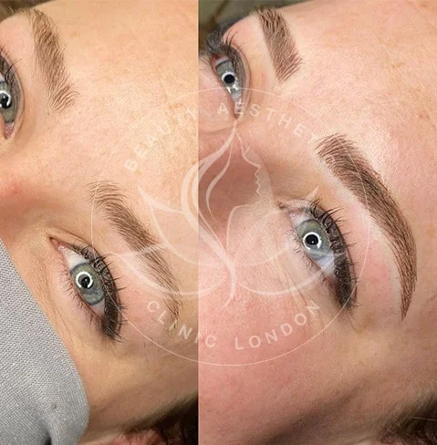 Detailed view of microblading eyebrows, highlighting the natural-looking, perfectly shaped brow strokes created with precision