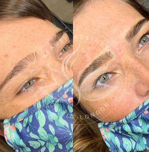 Detailed view of microblading eyebrows, highlighting the natural-looking, perfectly shaped brow strokes created with precision
