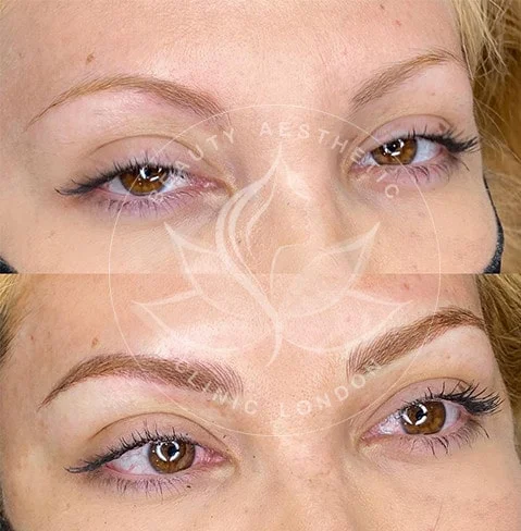Detailed view of microblading eyebrows, highlighting the natural-looking, perfectly shaped brow strokes created with precision