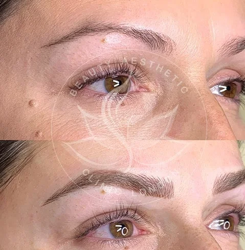 Detailed view of microblading eyebrows, highlighting the natural-looking, perfectly shaped brow strokes created with precision