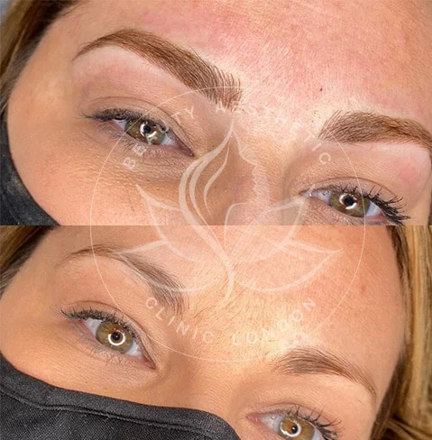 Detailed view of microblading eyebrows, highlighting the natural-looking, perfectly shaped brow strokes created with precision