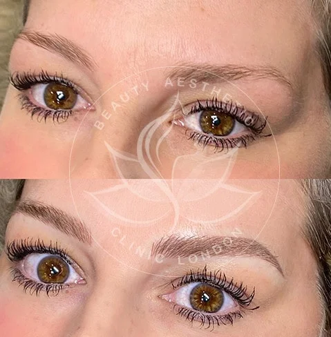 Detailed view of microblading eyebrows, highlighting the natural-looking, perfectly shaped brow strokes created with precision