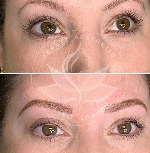 Detailed view of microblading eyebrows, highlighting the natural-looking, perfectly shaped brow strokes created with precision
