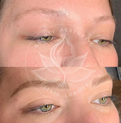 Detailed view of microblading eyebrows, highlighting the natural-looking, perfectly shaped brow strokes created with precision