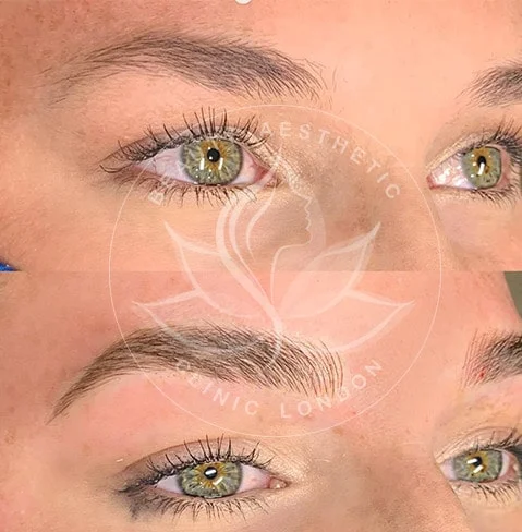 Detailed view of microblading eyebrows, highlighting the natural-looking, perfectly shaped brow strokes created with precision