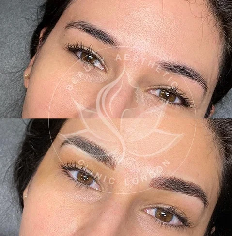 Detailed view of microblading eyebrows, highlighting the natural-looking, perfectly shaped brow strokes created with precision