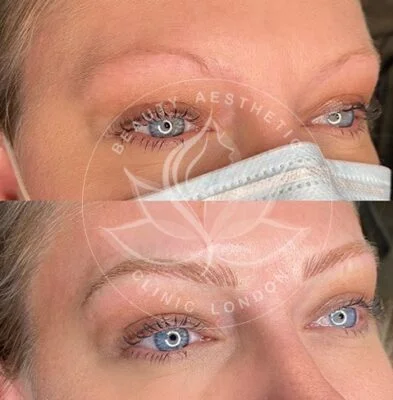 Detailed view of microblading eyebrows, highlighting the natural-looking, perfectly shaped brow strokes created with precision