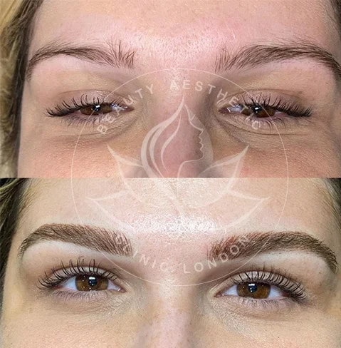 Detailed view of microblading eyebrows, highlighting the natural-looking, perfectly shaped brow strokes created with precision