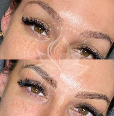 Detailed view of microblading eyebrows, highlighting the natural-looking, perfectly shaped brow strokes created with precision
