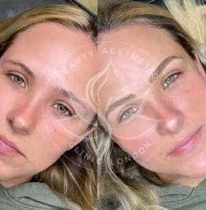 Detailed view of microblading eyebrows, highlighting the natural-looking, perfectly shaped brow strokes created with precision