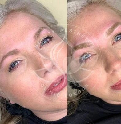 Detailed view of microblading eyebrows, highlighting the natural-looking, perfectly shaped brow strokes created with precision