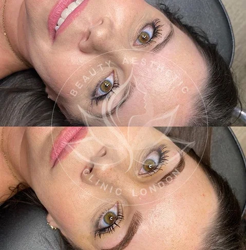 Detailed view of microblading eyebrows, highlighting the natural-looking, perfectly shaped brow strokes created with precision