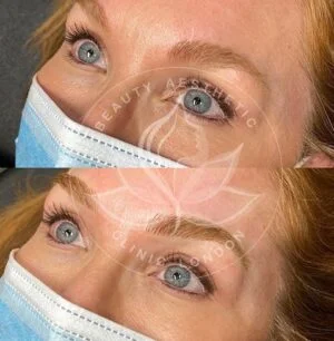 Detailed view of microblading eyebrows, highlighting the natural-looking, perfectly shaped brow strokes created with precision