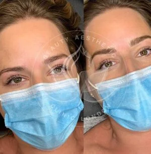 Detailed view of microblading eyebrows, highlighting the natural-looking, perfectly shaped brow strokes created with precision