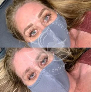 Detailed view of microblading eyebrows, highlighting the natural-looking, perfectly shaped brow strokes created with precision