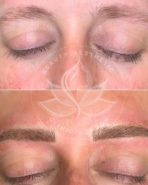 Detailed view of microblading eyebrows, highlighting the natural-looking, perfectly shaped brow strokes created with precision