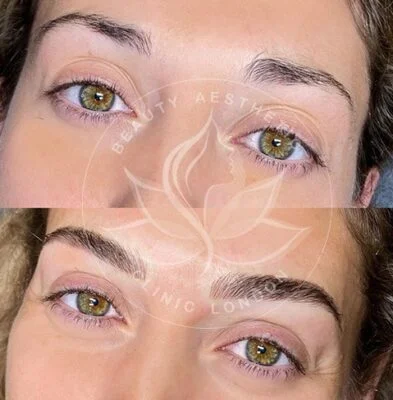 Detailed view of microblading eyebrows, highlighting the natural-looking, perfectly shaped brow strokes created with precision