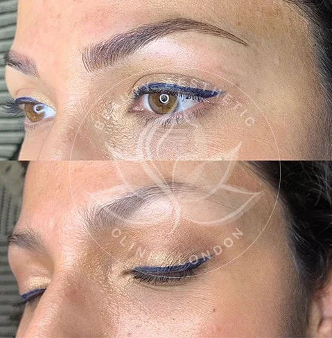 Detailed view of microblading eyebrows, highlighting the natural-looking, perfectly shaped brow strokes created with precision