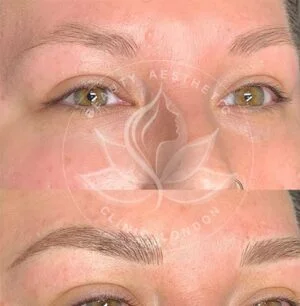 Detailed view of microblading eyebrows, highlighting the natural-looking, perfectly shaped brow strokes created with precision