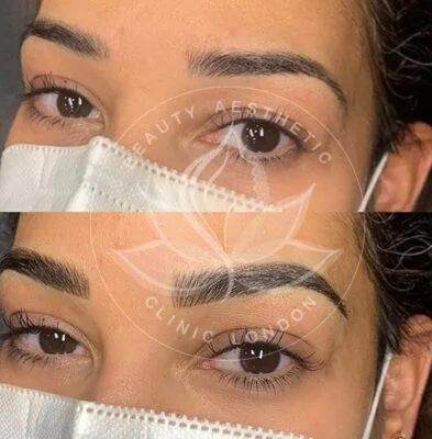 Detailed view of microblading eyebrows, highlighting the natural-looking, perfectly shaped brow strokes created with precision