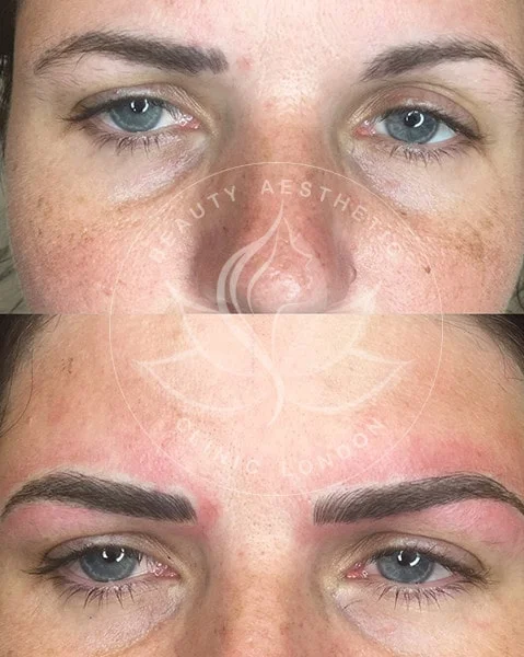 Detailed view of microblading eyebrows, highlighting the natural-looking, perfectly shaped brow strokes created with precision