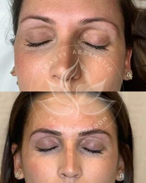 Detailed view of microblading eyebrows, highlighting the natural-looking, perfectly shaped brow strokes created with precision
