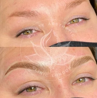 Detailed view of microblading eyebrows, highlighting the natural-looking, perfectly shaped brow strokes created with precision