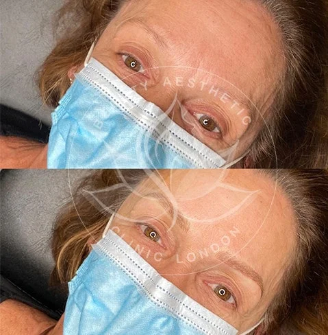 Detailed view of microblading eyebrows, highlighting the natural-looking, perfectly shaped brow strokes created with precision