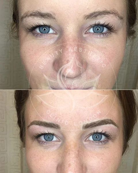 Detailed view of microblading eyebrows, highlighting the natural-looking, perfectly shaped brow strokes created with precision