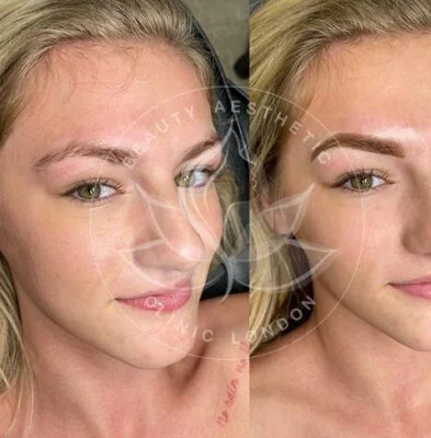 Detailed view of microblading eyebrows, highlighting the natural-looking, perfectly shaped brow strokes created with precision