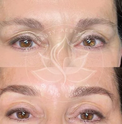 Detailed view of microblading eyebrows, highlighting the natural-looking, perfectly shaped brow strokes created with precision