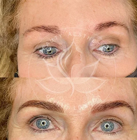 Detailed view of microblading eyebrows, highlighting the natural-looking, perfectly shaped brow strokes created with precision