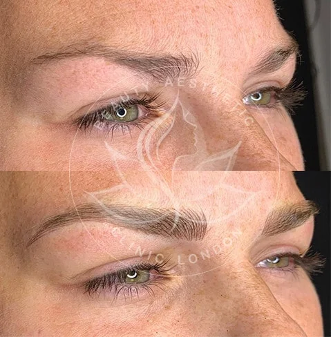 Detailed view of microblading eyebrows, highlighting the natural-looking, perfectly shaped brow strokes created with precision