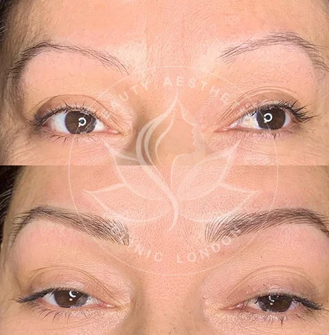 Detailed view of microblading eyebrows, highlighting the natural-looking, perfectly shaped brow strokes created with precision