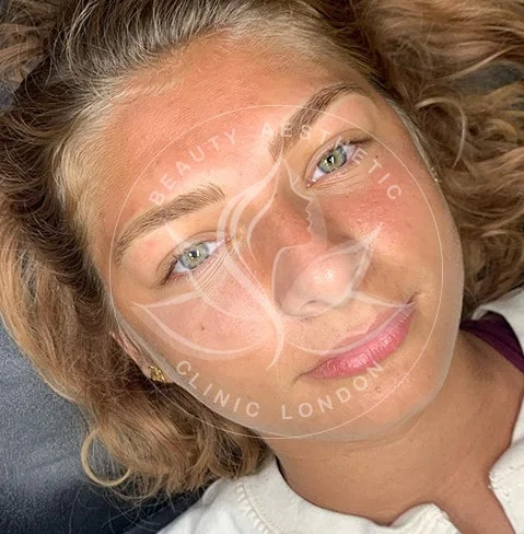 Detailed view of microblading eyebrows, highlighting the natural-looking, perfectly shaped brow strokes created with precision