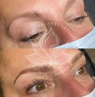 Detailed view of microblading eyebrows, highlighting the natural-looking, perfectly shaped brow strokes created with precision