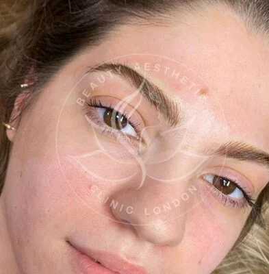 Detailed view of microblading eyebrows, highlighting the natural-looking, perfectly shaped brow strokes created with precision