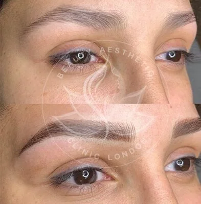 Detailed view of microblading eyebrows, highlighting the natural-looking, perfectly shaped brow strokes created with precision