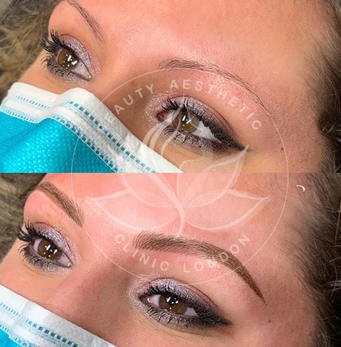 Detailed view of microblading eyebrows, highlighting the natural-looking, perfectly shaped brow strokes created with precision