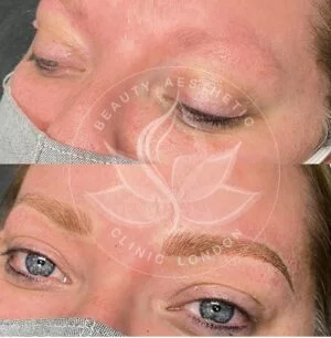Detailed view of microblading eyebrows, highlighting the natural-looking, perfectly shaped brow strokes created with precision