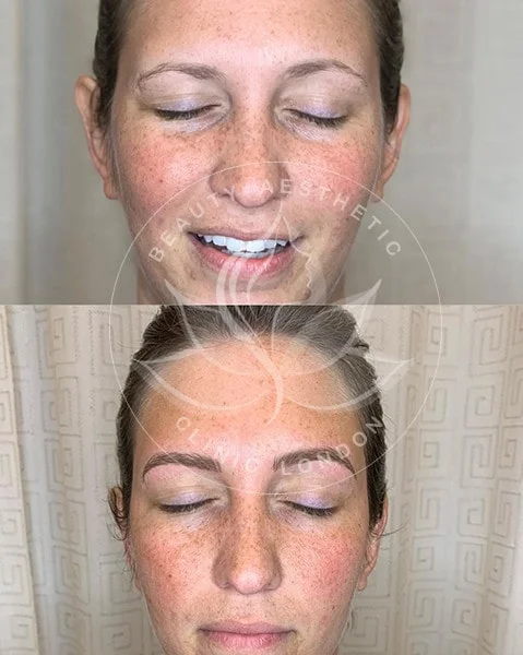 Detailed view of microblading eyebrows, highlighting the natural-looking, perfectly shaped brow strokes created with precision