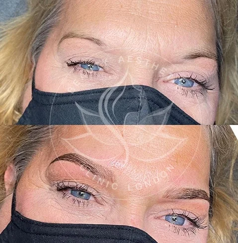 Detailed view of microblading eyebrows, highlighting the natural-looking, perfectly shaped brow strokes created with precision