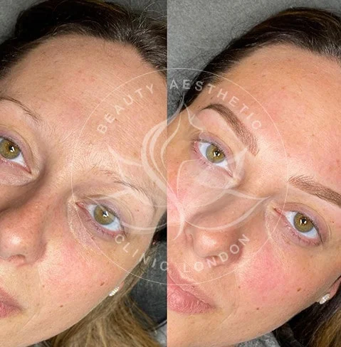 Detailed view of microblading eyebrows, highlighting the natural-looking, perfectly shaped brow strokes created with precision