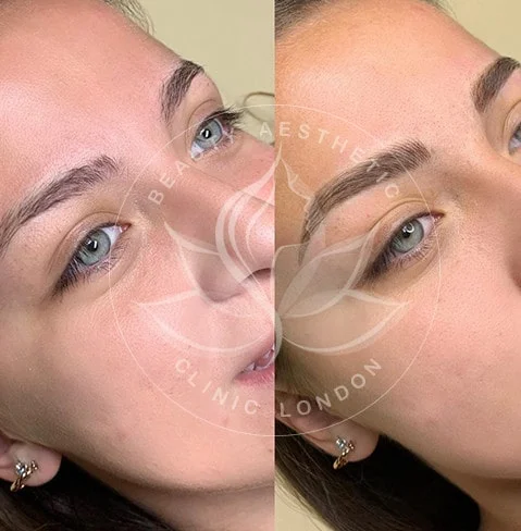 Detailed view of microblading eyebrows, highlighting the natural-looking, perfectly shaped brow strokes created with precision