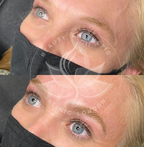 Detailed view of microblading eyebrows, highlighting the natural-looking, perfectly shaped brow strokes created with precision