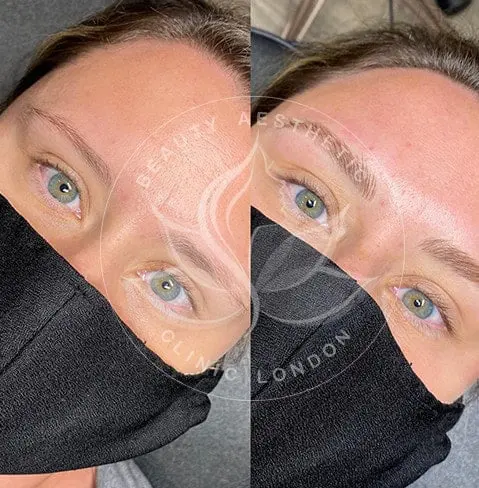 Detailed view of microblading eyebrows, highlighting the natural-looking, perfectly shaped brow strokes created with precision