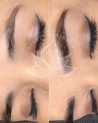 Detailed view of microblading eyebrows, highlighting the natural-looking, perfectly shaped brow strokes created with precision