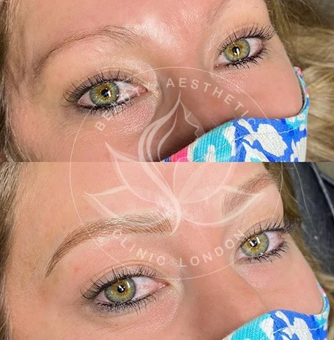 Detailed view of microblading eyebrows, highlighting the natural-looking, perfectly shaped brow strokes created with precision