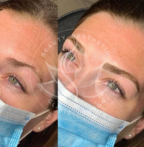 Detailed view of microblading eyebrows, highlighting the natural-looking, perfectly shaped brow strokes created with precision