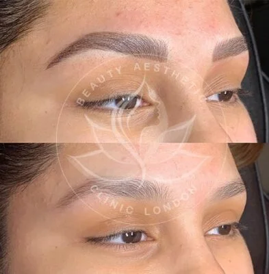 Detailed view of microblading eyebrows, highlighting the natural-looking, perfectly shaped brow strokes created with precision